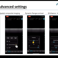 Безжична ултразвукова система Aco neo C62-VF74m.png