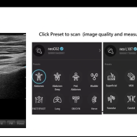 Безжична ултразвукова система Aco neo C62-iCus0.png