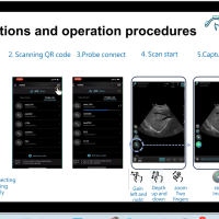 Безжична ултразвукова система Aco neo C62-jzzZU.png
