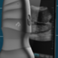 Безжична ултразвукова система Aco neo C62-paO6k.png